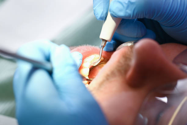 Best Pediatric Emergency Dentist in Lake Of The Pines, CA