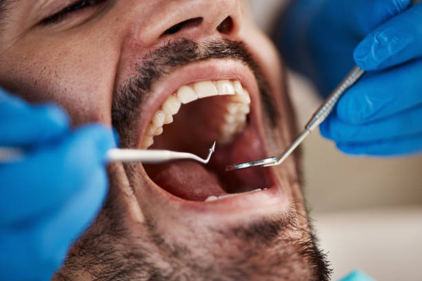 Best Orthodontic Emergency Dentist in Lake Of The Pines, CA